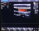 Chison i8 Color Doppler Ultrasound quality trolley based ultrasound system