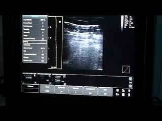 ECO3 demonstration with vascular, liver and kidney