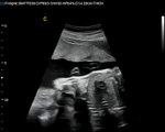 Q5Vet Fetal Heart Best color Doppler Ultrasound for veterinary application