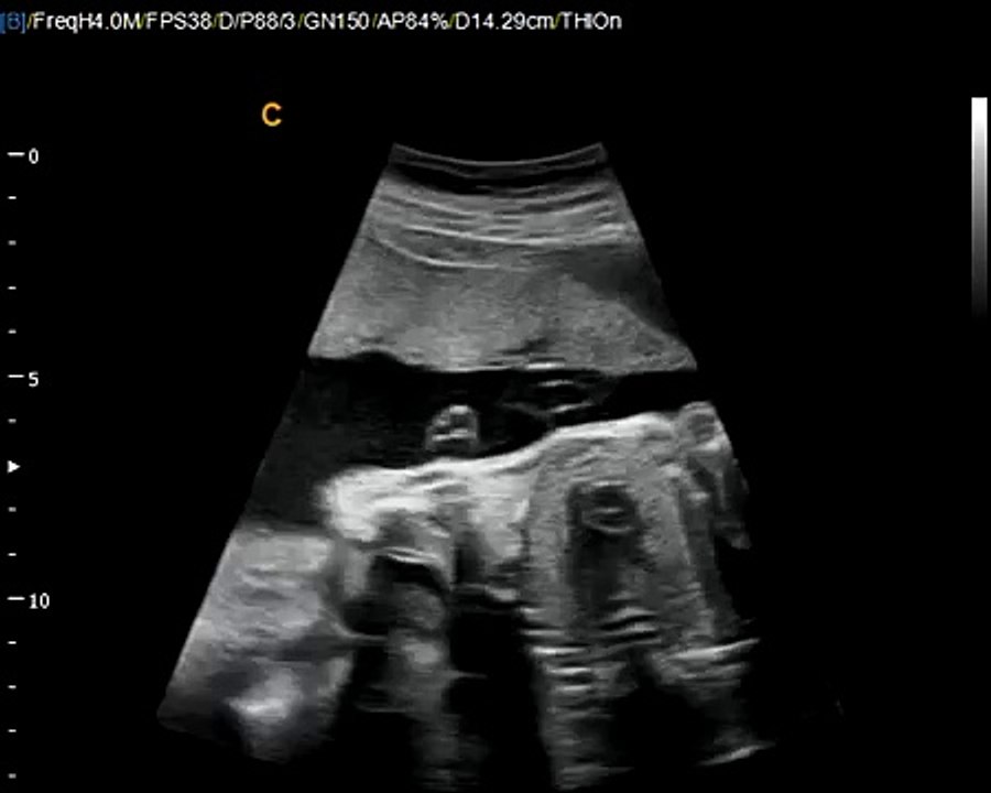 Q5Vet Fetal Heart Best color Doppler Ultrasound for veterinary application