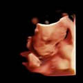 Chison Qbit 4D Virtual HD four Dimensional image of baby, Fetal ultrasound