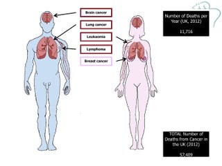 Deaths from cancer (UK 2012)