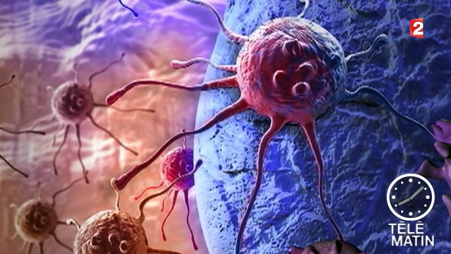 Journée mondiale de lutte contre le cancer : l'accent mis sur la prévention