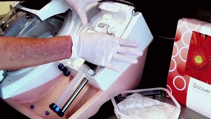 Neograft Automated Hair Restoration @ Wise Center New Jersey - (973) 305-1400