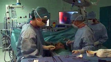 La thoracocospie, un espoir pour soigner le cancer du poumon