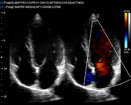 Chison Q9 Cardiac BBC Ultrasound Portable digital Ultrasound System