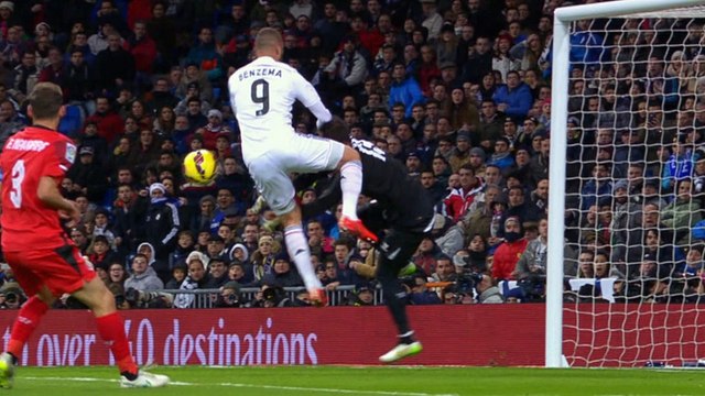 Beto, ingresado por una luxación acromioclavicular en el hombro izquierdo