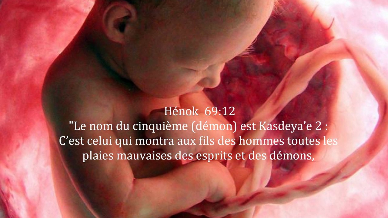 Avortement le génocide silencieux