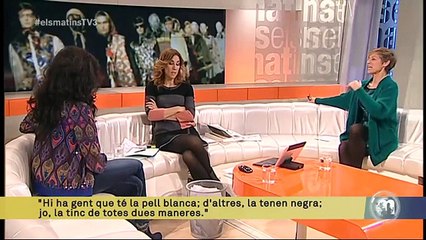 TV3 - Els Matins - Winnie Harlow: "Vaig decidir dir-me a mi mateixa que era preciosa"