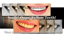 Teeth Whitening London - Teeth Whitening London For A Pearly White Smile