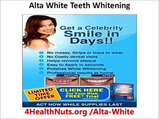 Sinsational Smile teeth whitening