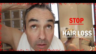 Stop Hair Loss ! Men's Hair Loss Solution
