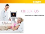 Get morevinfo on Chison Q5 Large screen high class ultrasound product Introduction
