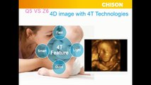 4D Images taken with Chison Q5 portable ultrasound machine