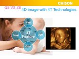 Why Chison Q5 is most recommended 4D color OB GYN ultrasound Marketing Analysis