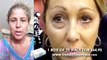 Instantly Ageless Reviews | Instantly Ageless before and after photos