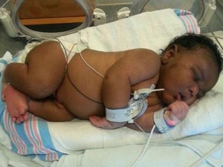Woman Gives Birth To The Biggest Baby Ever (14.1 Pounds)