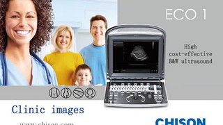 Chison ECO1 portable ultrasound Clinic Images from different organs