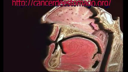 como forma el cáncer de pulmón