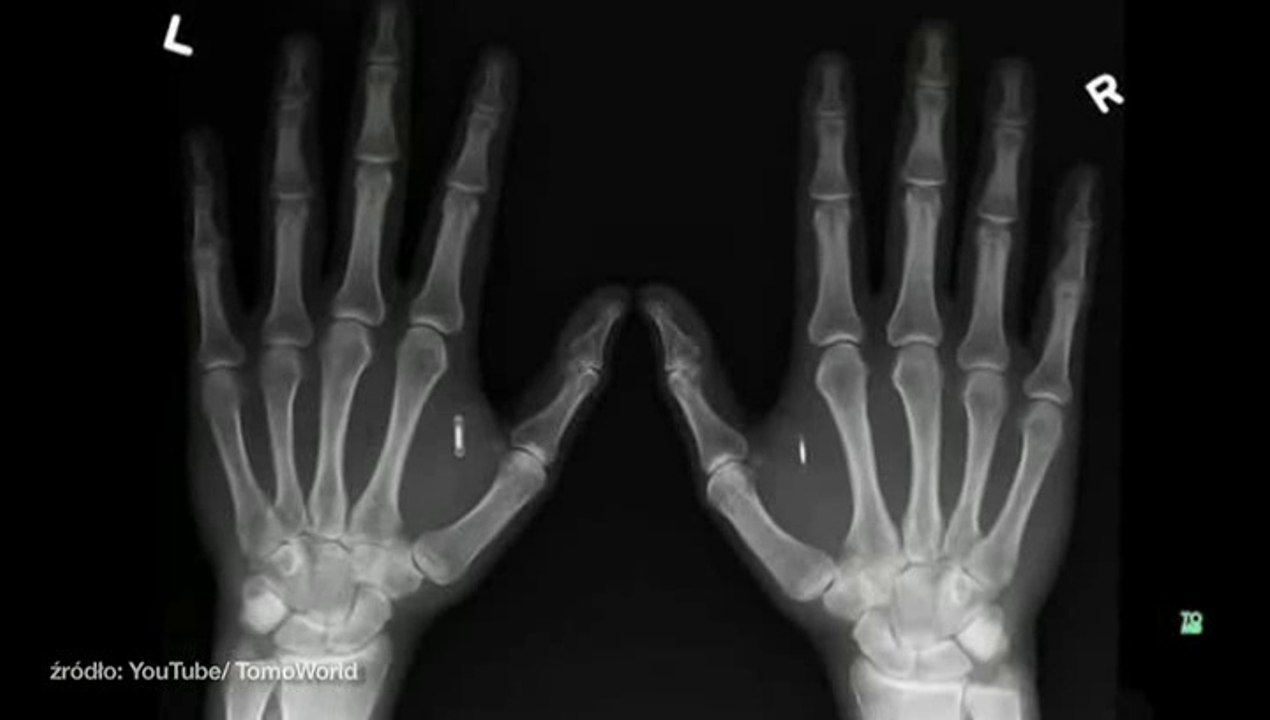 Szwedzka firma wszczepia pracownikom chipy / Era niewolników tuż tuż! (05.02.2015)