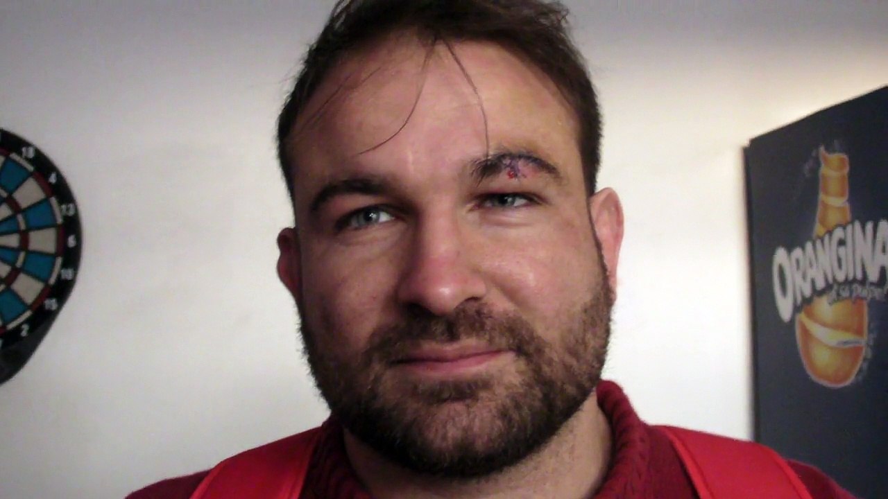 Rugby Fédérale 1 - Vincent Giaccoleto après  US Bressane - Aubenas