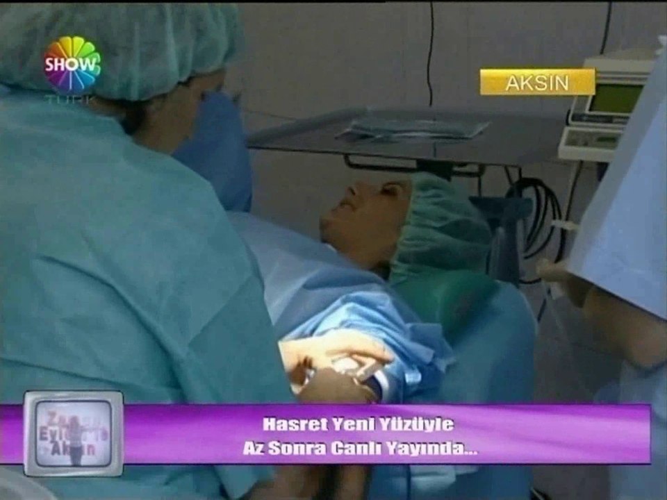 nasen ästhetik berlin estetik burun cerrahisi dr. yasar sarigül lacomed clinic