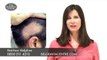 Hair Care - Hair Loss - Natural Ayurvedic Home Remedies