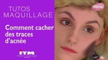 Maquillage - Comment cacher des traces d'acné ?