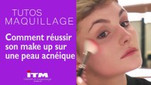 Maquillage - Comment réussir son make up sur une peau acnéique