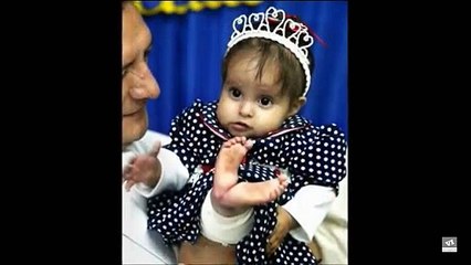 Baby Born as 'Little Mermaid' Recieves a Miracle
