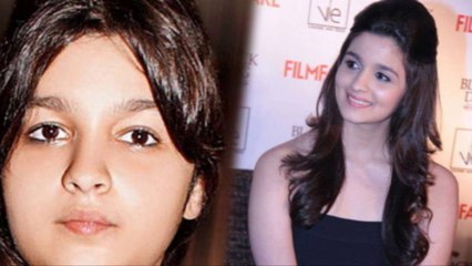 Bollywood Actress Undergoes Weight Loss Operation !