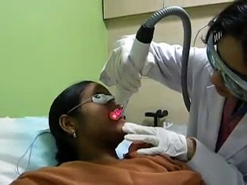 Facial Hair Reduction & Hair Removal ND-YAG Laser Treatment in Mumbai, India- Dr Rinky Kapoor