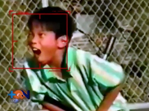 Más Que Curiosos: ¿Por qué sentimos dolor?