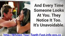 How To Whiten Teeth At Home, Home Remedies For Whitening Teeth, How To Have Whiter Teeth
