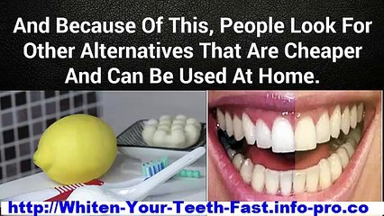 How To Make Your Teeth Whiter, Whiten Your Teeth At Home, Home Teeth Whitening Remedies