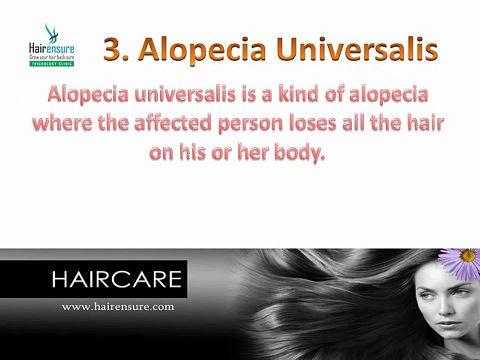 Androgenetic Alopecia Treatment in India