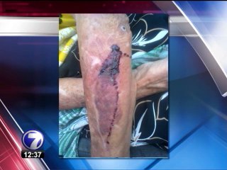 OIJ investiga agresión contra mujer de 80 años en Guápiles