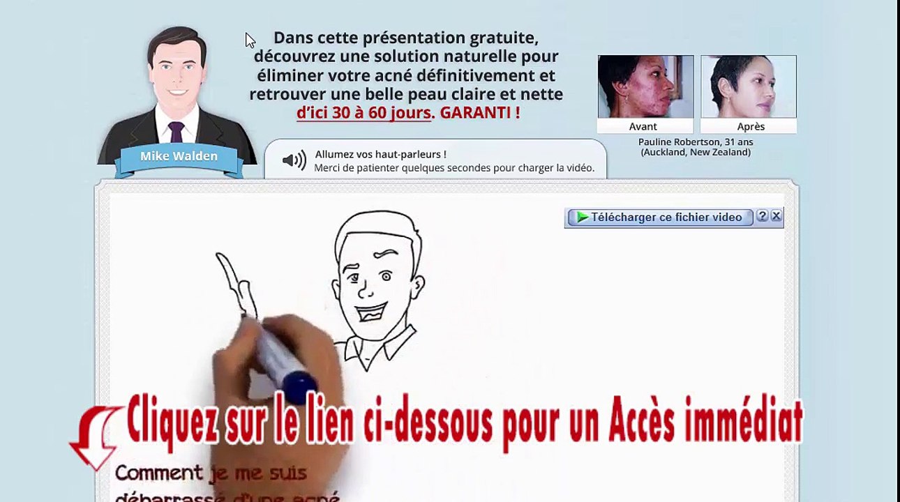 Télécharger méthode plus jamais d'acné pdf livre gratuit de mike walden avis
