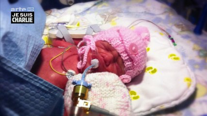 Arte - Incroyables bébés - 09-01-2015 22h57 13m (8557)