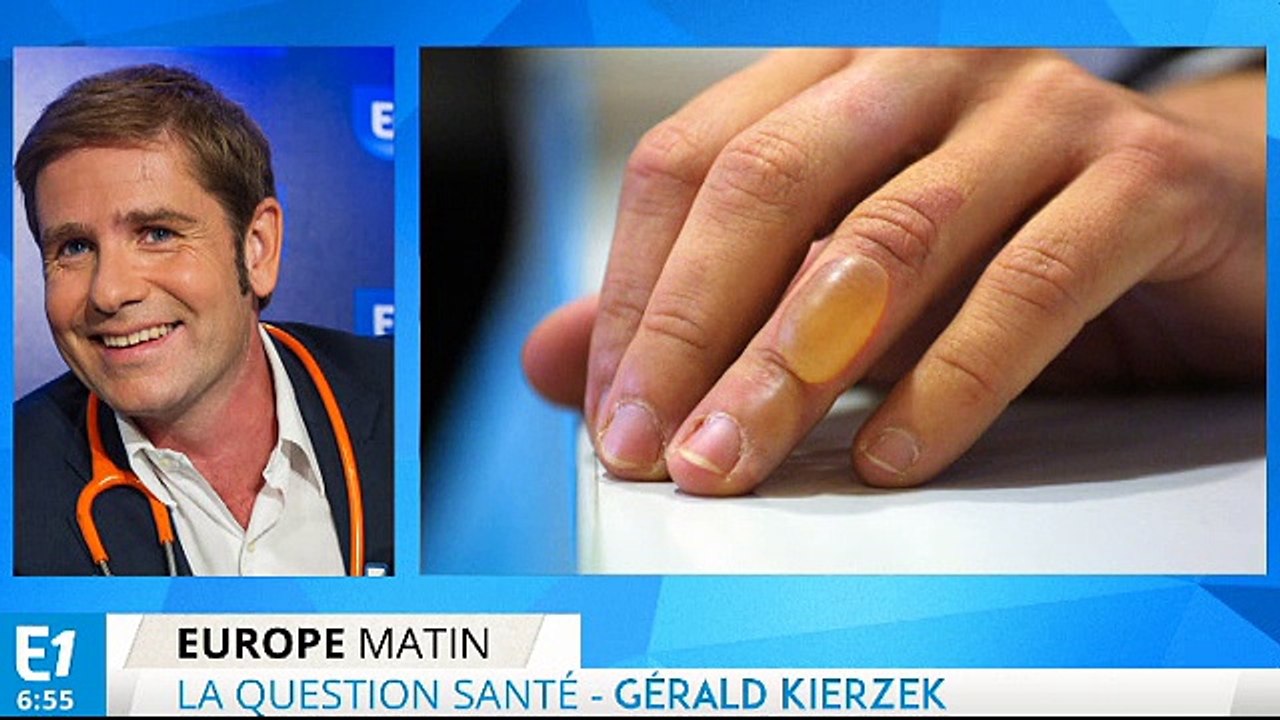 Brûlures, comment les soigner ?