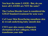 Best Acne Treatment | Carbon Dioxide Laser Skin Resurfacing for Acne Scars - Dr. Rinky Kapoor