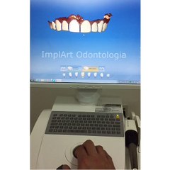 Lentes de contato dentais no Cerec