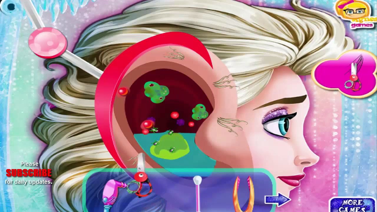 Frozen princess Elsa Ear Emergency game for kids