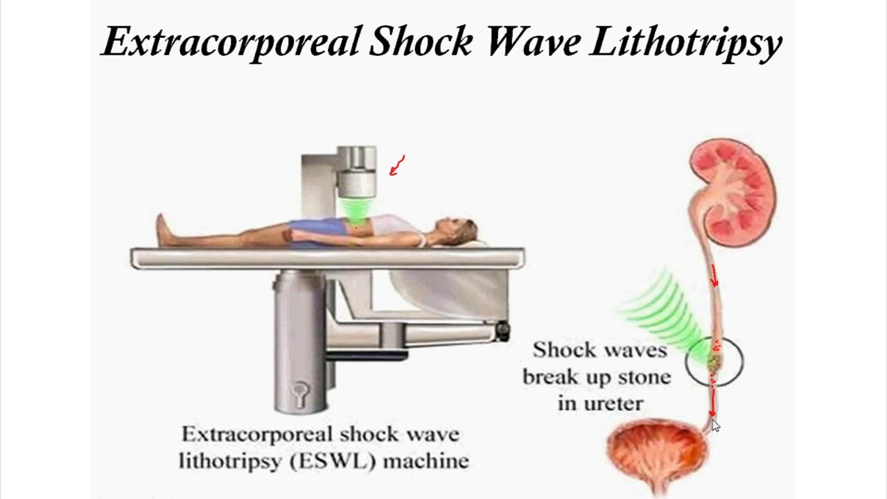 Kidney, Its Problems & Cures (i)