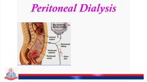 Types of Dialysis/Kidney Transplant