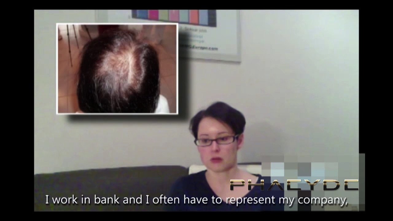 Hair Implants Hair Transplantation for Women - PHAEYDE Clinic