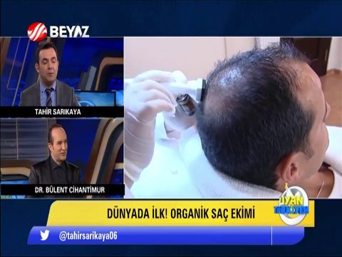 Organik saç ekimi nasıl fiyatları