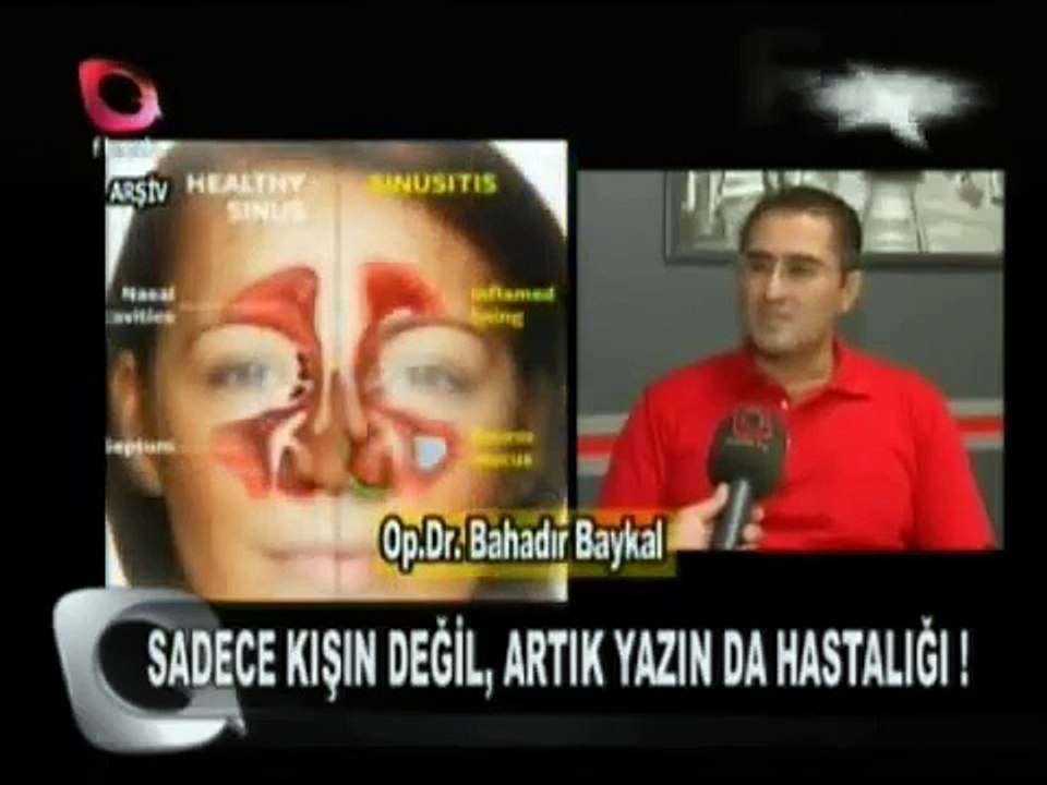 Sinüzit Belirtileri ve Tedavisi