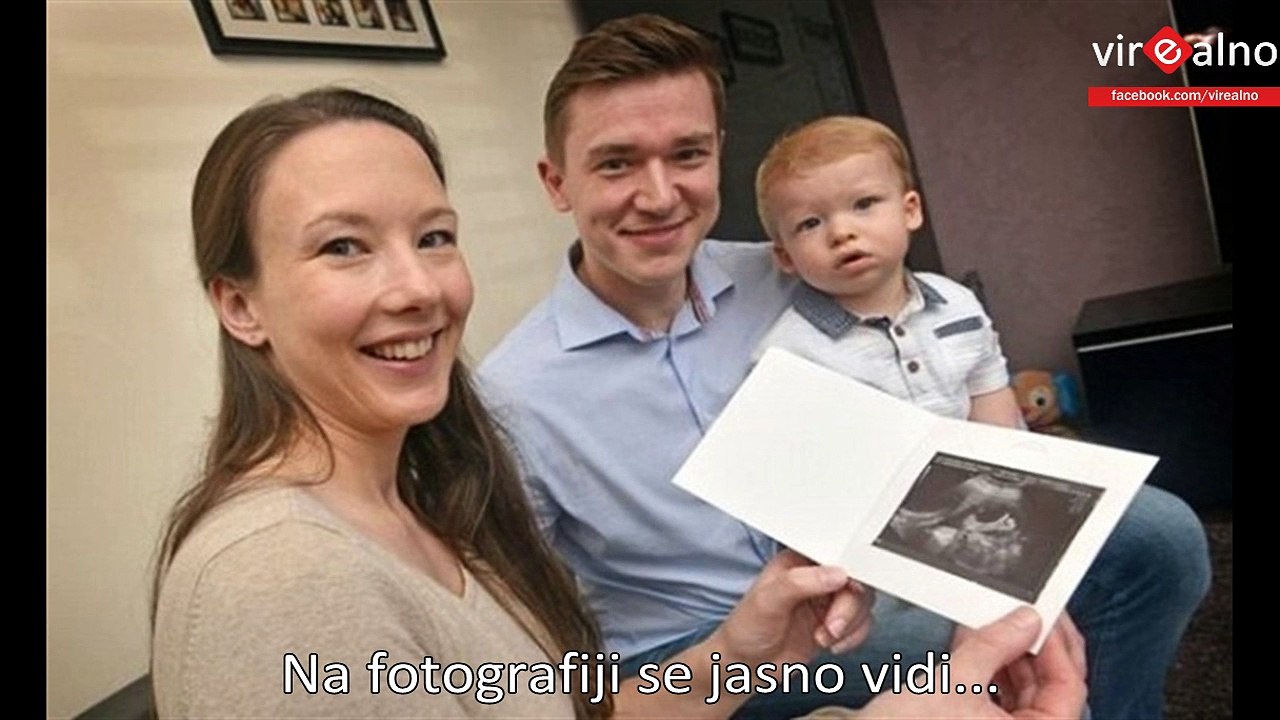 Baby Thumbs Up At Ultrasound Photo