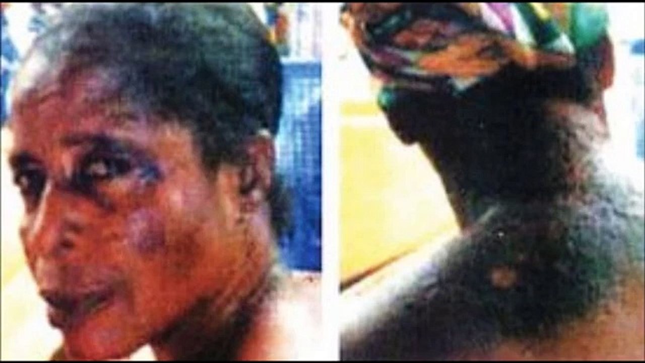 SKIN BLEACHING ADDICTION (Low)